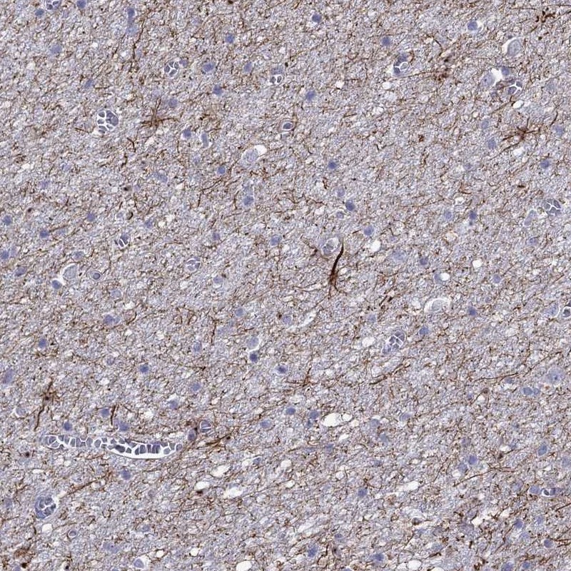 Anti-TMEM155 Antibody