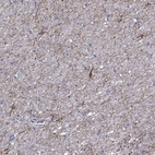Anti-TMEM155 Antibody