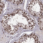 Anti-SNAPC2 Antibody
