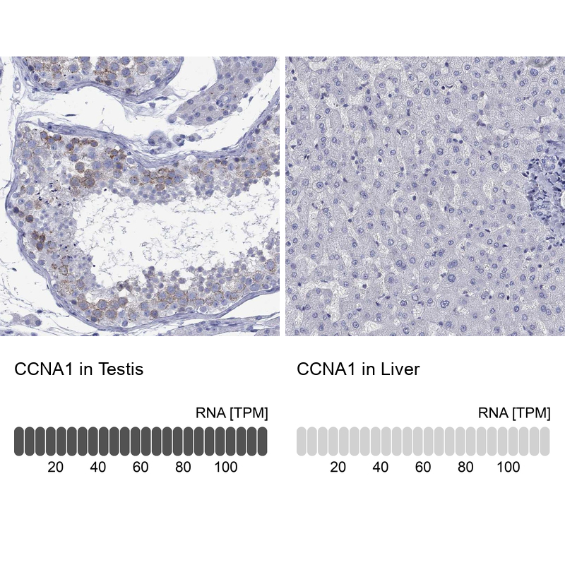 Anti-CCNA1 Antibody