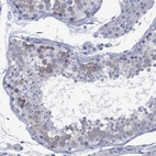 Immunohistochemical staining of human testis shows high expression.