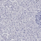 Immunohistochemical staining of human liver shows low expression as expected.