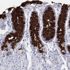 Anti-MUC5AC Antibody