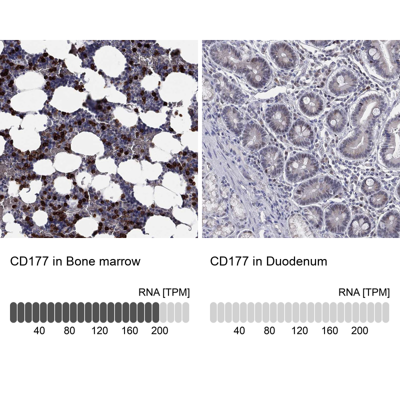 Anti-CD177 Antibody