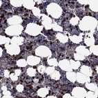 Immunohistochemical staining of human bone marrow shows high expression.