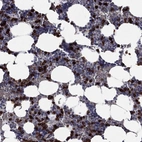Immunohistochemical staining of human bone marrow shows high expression.