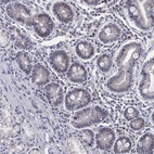 Immunohistochemical staining of human duodenum shows low expression as expected.