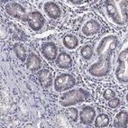 Immunohistochemical staining of human duodenum shows low expression as expected.
