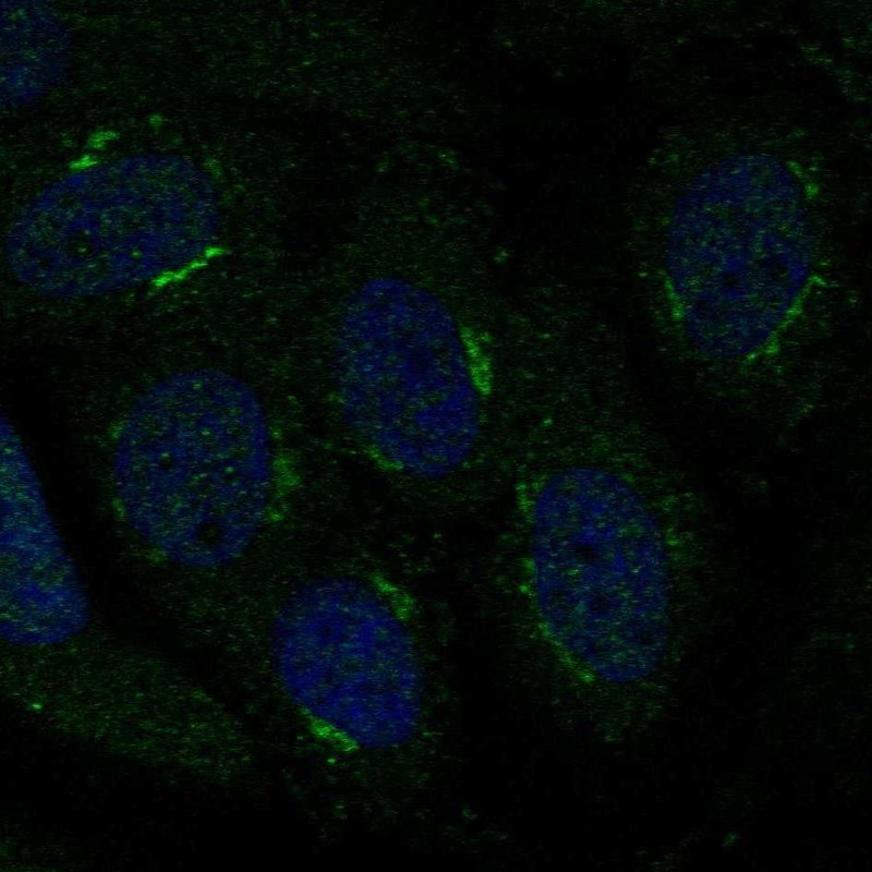 Anti-TMBIM4 Antibody