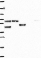 Lane 1: Marker [kDa] 250, 130, 95, 72, 55, 36, 28, 17, 10 | Lane 2: RT4 | Lane 3: U-251 MG | Lane 4: Human Plasma | Lane 5: Liver | Lane 6: Tonsil