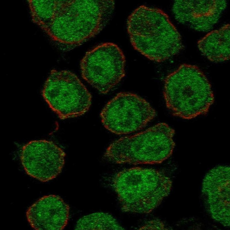 Anti-ZNF333 Antibody