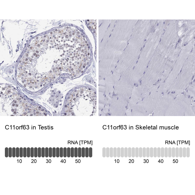 Anti-C11orf63 Antibody
