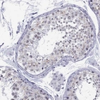 Immunohistochemical staining of human testis shows high expression.