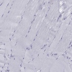 Immunohistochemical staining of human skeletal muscle shows low expression as expected.