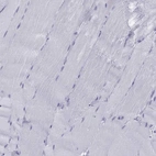 Immunohistochemical staining of human skeletal muscle shows low expression as expected.