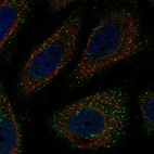 Anti-WNK3 Antibody