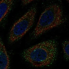Anti-WNK3 Antibody