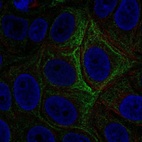 Anti-ADCY5 Antibody
