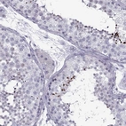 Anti-DMRT3 Antibody