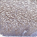 Anti-TMPRSS11D Antibody