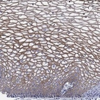 Anti-TMPRSS11D Antibody