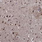 Immunohistochemical staining of human cerebral cortex shows high expression.