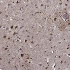 Immunohistochemical staining of human cerebral cortex shows high expression.