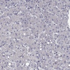 Anti-CLSTN1 Antibody