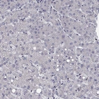 Immunohistochemical staining of human liver shows low expression as expected.