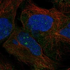 Anti-ZNF728 Antibody