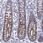 Anti-OLFM4 Antibody