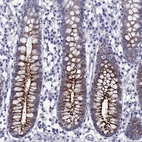 Immunohistochemical staining of human small intestine shows high expression.