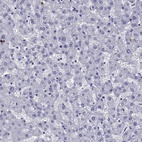 Anti-OLFM4 Antibody