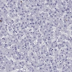 Immunohistochemical staining of human liver shows low expression as expected.