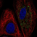 Anti-B4GALT5 Antibody