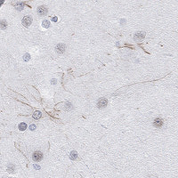 Anti-KCNH8 Antibody
