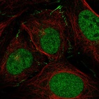 Anti-ZNF469 Antibody