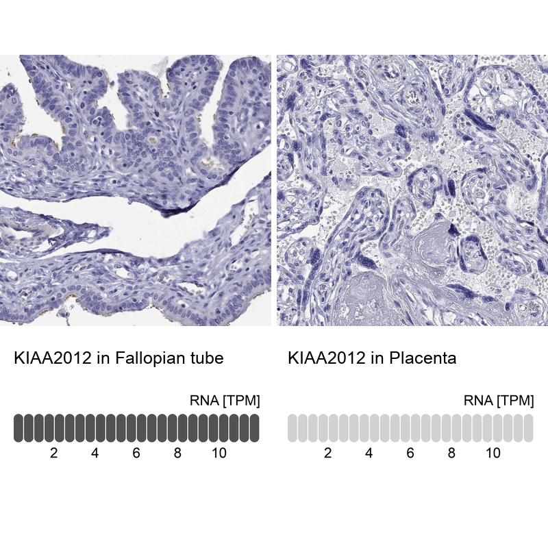 Anti-KIAA2012 Antibody