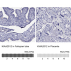 Anti-KIAA2012 Antibody