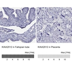 Anti-KIAA2012 Antibody