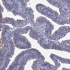 Immunohistochemical staining of human fallopian tube shows high expression.