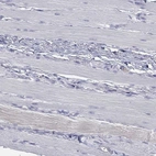 Immunohistochemical staining of human skeletal muscle shows low expression as expected.