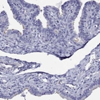 Immunohistochemical staining of human fallopian tube shows high expression.