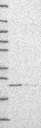 Lane 1: Marker [kDa] 250, 130, 95, 72, 55, 36, 28, 17, 10 | Lane 2: RT4 | Lane 3: U-251 MG