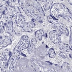 Immunohistochemical staining of human placenta shows low expression as expected.