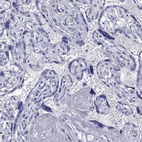 Immunohistochemical staining of human placenta shows low expression as expected.