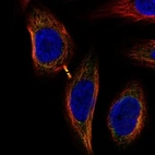 Immunofluorescent staining of human cell line SiHa shows localization to cytosol, mitochondria & cytokinetic bridge.