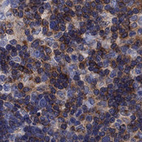 Anti-PSD4 Antibody