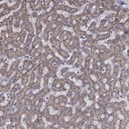 Anti-HPS5 Antibody