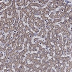 Anti-HPS5 Antibody